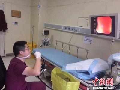 为体验病人感受给自己做胃肠镜 “硬核”医生走红网络