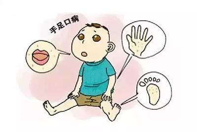 黄冈人注意了！这种病毒出现新症状，近期进入感染高发季！