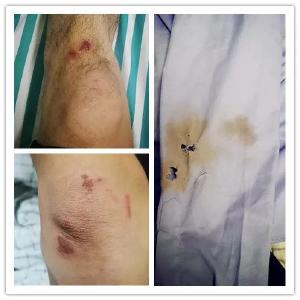 这一扑，救下两条人命！