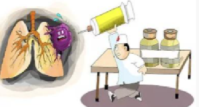 规范化治疗是肺癌患者长生存“基石”
