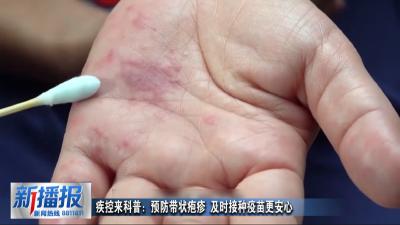 生活小贴士︳疾控来科普：预防带状疱疹 及时接种疫苗更安心