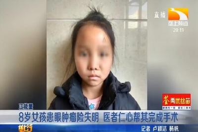 8岁女孩患眼肿瘤险失明 医者仁心帮其完成手术