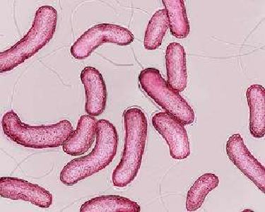 检测到弧菌就要消毒杀菌吗？弧菌和弧菌病一字之隔，结果千差万别！