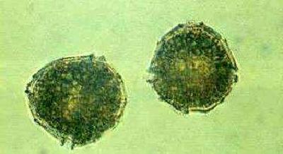 春季低温三毛金藻各地接连爆发，养殖户如何应对？