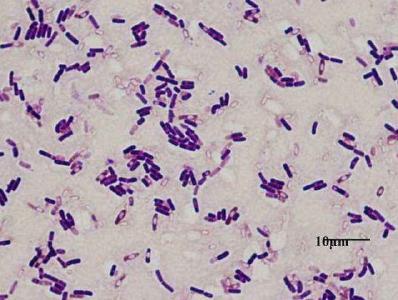 水产养殖中为什么要用芽孢？那种芽孢更适合？